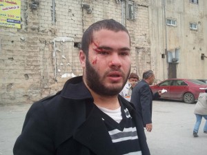 اصابات اثر اشتباكات في مسيرة اربد - صور