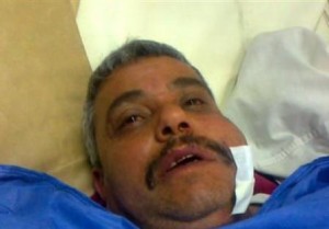 ناجون من مجزرة العدسية .. هذا ما جرى - فيديو