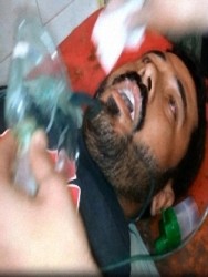 موثق بالفيديو والصور.. طيران الأسد يهاجم سراقب بالغازات السامة