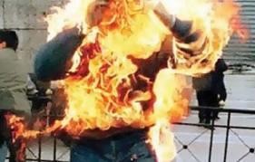 خلافته الزوجية تدفعه لحرق قدميه