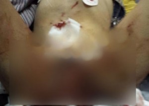 تجريم والد الطفل الذي نهشته الكلاب الضالة