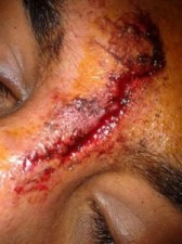 أهالي 'مخيم غزة' يناشدون الأمن السماح لهم بمعالجة المصابين