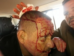 صور واسماء - انفجار يستهدف وفد "رابطة الكتاب الاردنيين" في سوريا ووقوع 4 اصابات