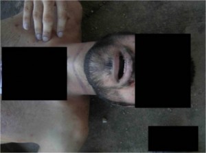 اردنيين ظهرت ملامحهم في صور القتلى جراء التعذيب في سجون النظام السوري