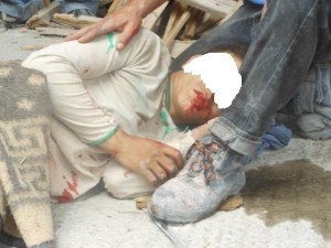 قضبان حديدية تخترق صدر عشريني سقط عليها من الطابق الخامس