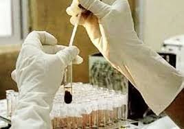 اصابتين جديدتين بالكورونا في عمان والزرقاء