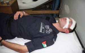 إصابة خطيرة لشرطي برصاصة من سلاحه الشخصي عن طريق الخطأ في المفرق