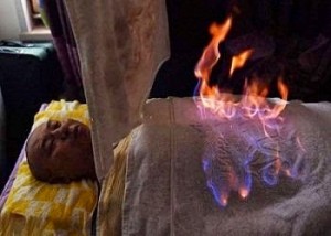 بالصورة....أطباء يشعلون النار في مرضاهم!