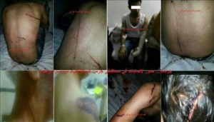 بالصور...أسرة تتعرض للقتل والتقطيع بالسيوف والخناجر في مستشفى جرش الحكومي