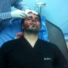 بالصورة...3 شبان يعتدون على طبيب بـ"مسدس" اثناء عملة في عيادتة بالرصيفه