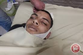 استشهاد شاب فلسطيني خلال اقتحام الاحتلال مخيم الدهيشه..