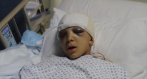 أصيب قبل 9 أيام بحادثة انهيار مدرسة القمر .. "عبد الرحمن" يستفيق من غيبوبته