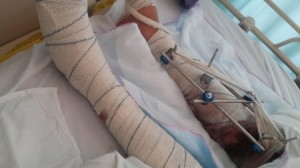 شاهد بالصور... الطالب الشرفات ضحية العنف الجامعي في جامعة آل البيت