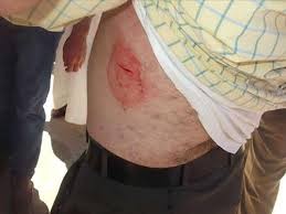 بسبب فتاة في الجبيهة ... مشاجرة وطعن باداة حادة في منطقتي الصدر والبطن