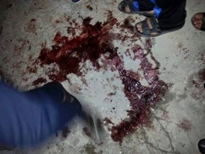 بالأسماء ... 6 اصابات من عائلة" عوض المخادمة " بانفجار قذيفة سورية في الرمثا