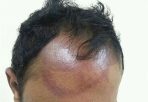 أول يوم للعام الدراسي.. طلاب يعتدون على معلم في مدرسة جحيفة الثانوية بإربد