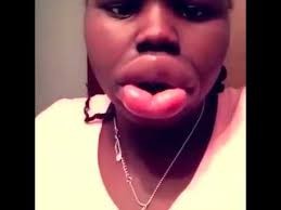 ازدياد اقبال عمليات تكبير الصدر وشفط الدهون وشد البطن وإزالة التجاعيد في الوجه... والحكومة ترفع رسوم الترخيص