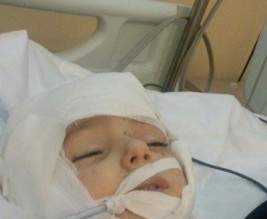 اصابة طفلة بعيار ناري طائش اخترق رأسها واستقر في رقبتها بمدينة السلط