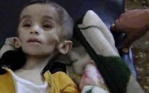 رئيس الجامعة الأردنية : "التجويع حتى الموت" حالات سجلت كإساءة للطفل