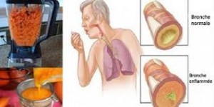 شراب قوي للسعال وإزالة المخاط من الرئتين في اسرع وقت ممكن!