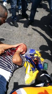 شهيدان وعشرات الإصابات في جمعة الغضب (صور)