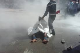 عشريني يقدم على حرق نفسه في عجلون وحالته الصحيه سيئة