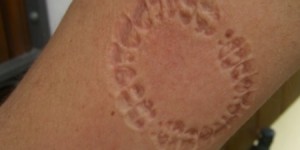 شخص يعض معلمة داخل مدرسة في منطقة القسطل ... والتربية توضح