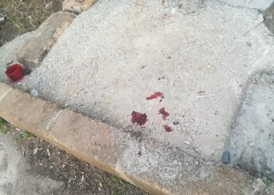 إصابة شخصين إثر إنفجار برميل يحتوي على مواد كيميائية في الأغوار الشمالية