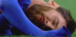 بعد ضربة قوية في الوجه .. ميسي نزف كثيرًا!