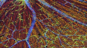 ابتكار جديد قد يُحدث ثورة في علاج السرطان!