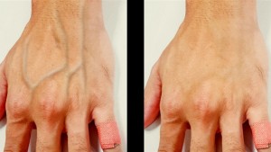 أسباب غير متوقعة لظهور عروق اليدين!
