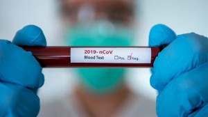 اجراء الفحوصات النهائية للمصاب بالكورونا .. وخروجه مرهون بنتيجة "الطبقية"