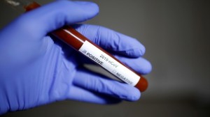 وزارة الصحة: ارتفاع عدد الإصابات بفيروس كورونا إلى 48 من ضمنهم حالة شفاء واحدة