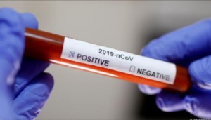 عزل عمارتين في الجويدة ولواء القويسمة بعد تسجيل إصابات بفيروس كورونا