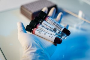 تسجيل (5) إصابات جديدة بفيروس كورونا من بينها واحدة "محلية" و(7) حالات شفاء