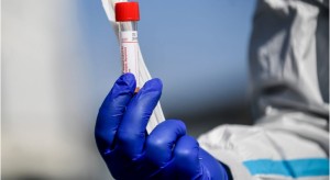 تسجيل ١٤٢ اصابة محلية  بفيروس كورونا في الاردن