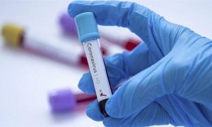 22 وفاة و124 اصابة كورونا في الاردن