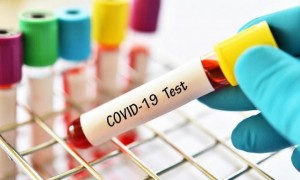 تسجيل 188 إصابة بكورونا في مصنع بمدينة الحسن الصناعية