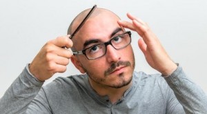 دراسة تكشف عن علاج طبيعي للصلع !