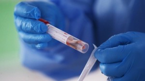 الشبول: عزل 10 مخالطين لحالة اوميكرون مؤسسيا