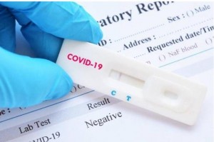 الغذاء والدواء: الفحص المنزلي للكشف عن كورونا غير معتمد