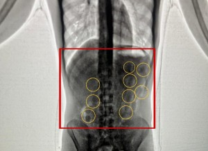 احباط تهريب 2 كغم من الكوكايين داخل أحشاء شخصين في مطار الملكة علياء الدولي