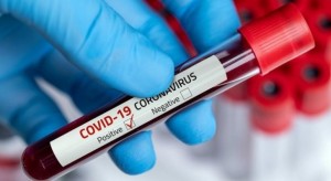 وفاة و2135 إصابة بفيروس كورونا في الأردن خلال أسبوع