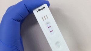 الحكومة: زيادة نسبة فحوصات التحري عن الكوليرا