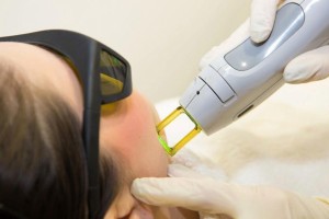 مهيدات: منع استيراد أجهزة الليزر إلا بموافقة وزارة الصحة