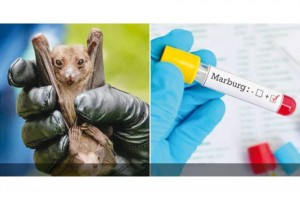 بلعاوي يوصي بإجراءات لمواجهة فيروس «ماربورغ»